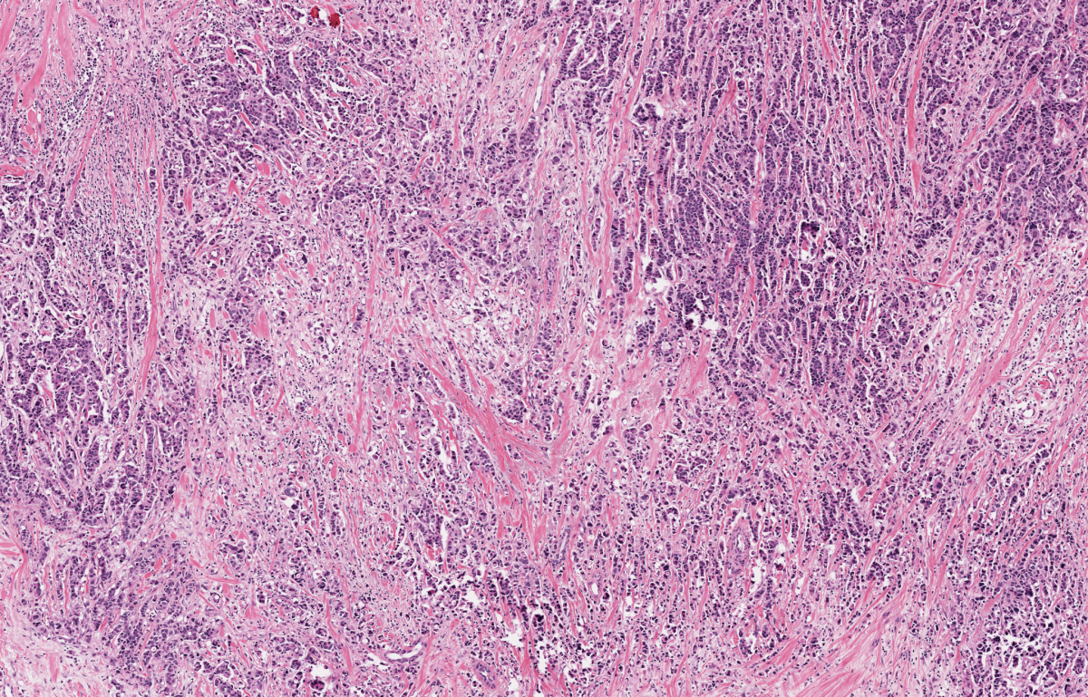 Stratipath Histological slide image_NHG2