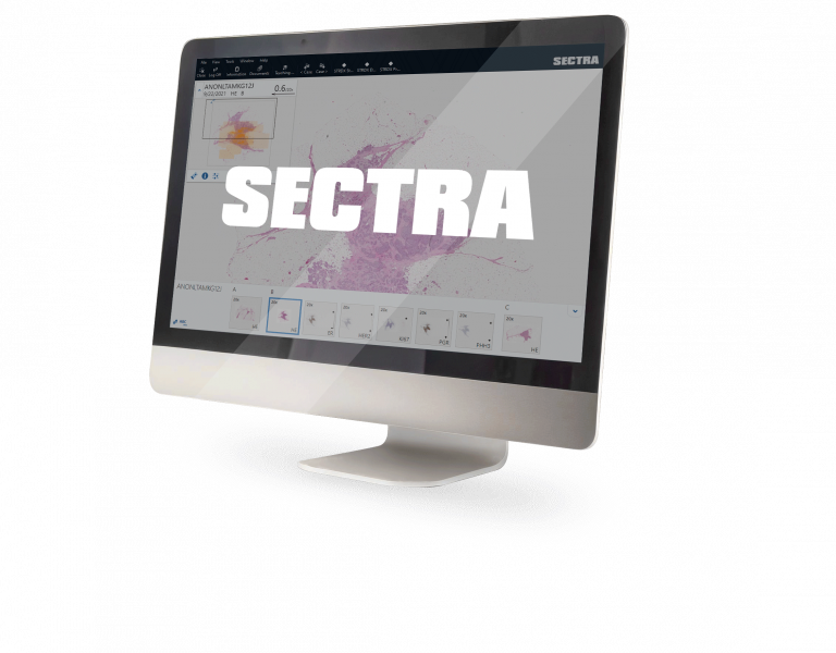 SECTRA’s digital pathology system